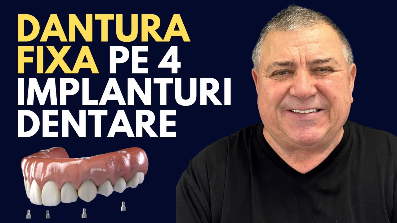 Parere Dinti Ficsi in 24 de Ore - Dl. Augustin explica cum a decurs tratamentul pe implanturi.