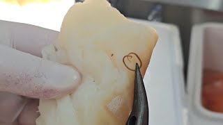Are there concerns about worms in the fish? Live presentation with Rabbi Perl from KCL Hashgacha.