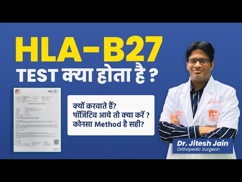 What is the HLA-B27 test? Back Pain Test (What to do if it's positive) Dr. Jitesh Jain