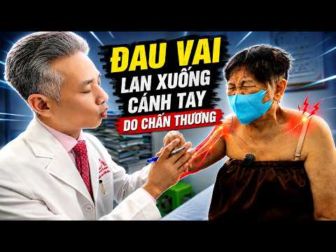 Đau vai lan xuống cánh tay sau chấn thương: Đừng chủ quan