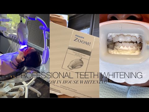Home Teeth Whitening