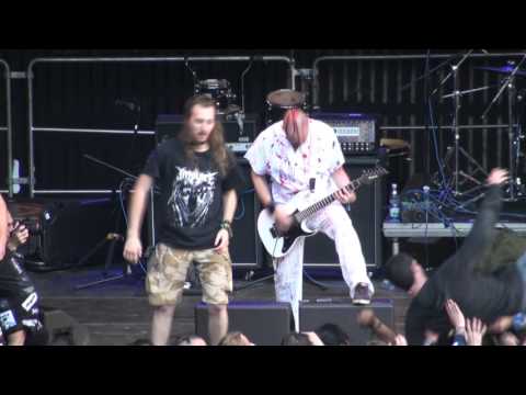 GENERAL SURGERY Live At OBSCENE EXTREME 2015 HD