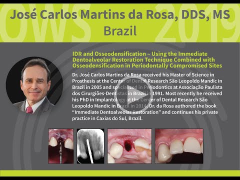 IDR and Osseodensification - José Carlos Martins da Rosa