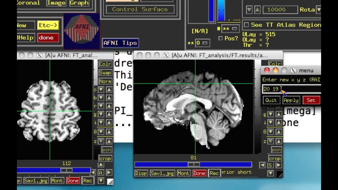 Functional Connectivity in AFNI, Step 3: Creating Connectivity Maps