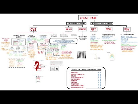 Approach to Chest Pain