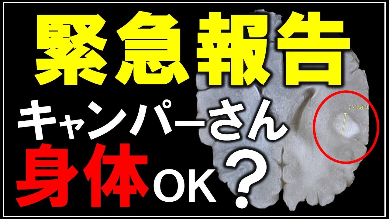 【緊急報告！】脳腫瘍でDIYもキャンプも一時休止。身体のサインに注意し皆さん長生きを【DIY キャンプ 186】