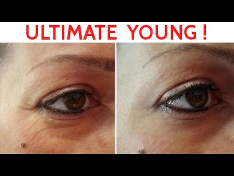 Trucco della persona con lentiggini video Scortecci peptide un bene per chiarificazione di pelle e correzione di posti di pigmentary