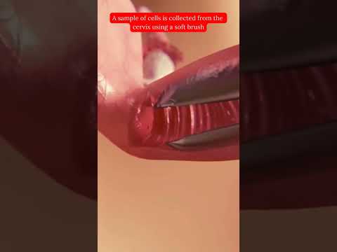 Pap Test 💖😍#shorts #paptest #Healthcare #EarlyDetection