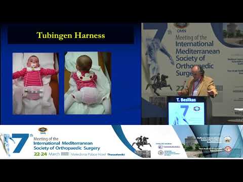 T Beslikas - Neglected developemental hip dysplasia. Conservative treatment