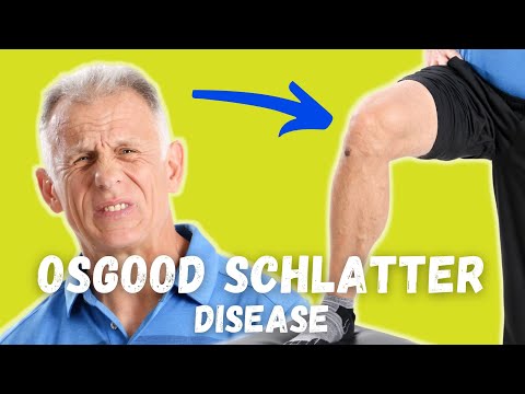 What is Causing Your Knee Pain? Osgood Schlatter Disease? How to Tell