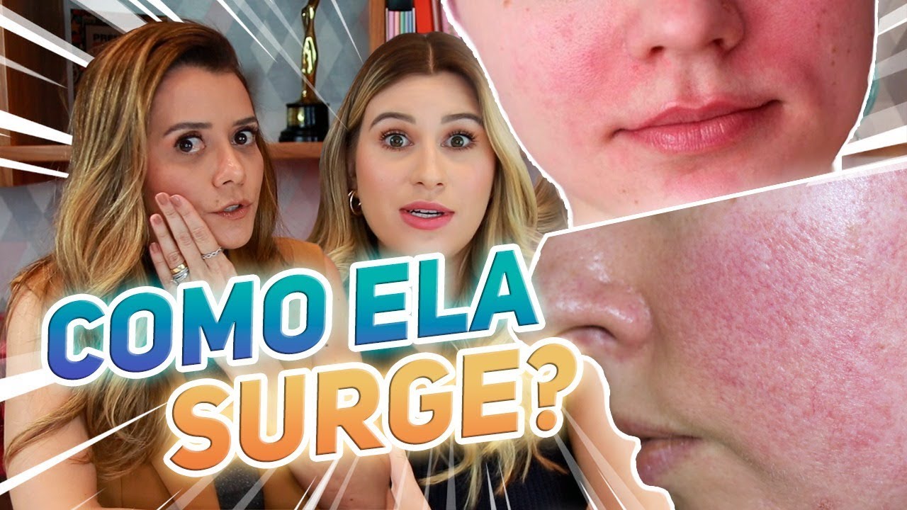 ROSÁCEA: O que é e como cuidar? - Skin Secrets