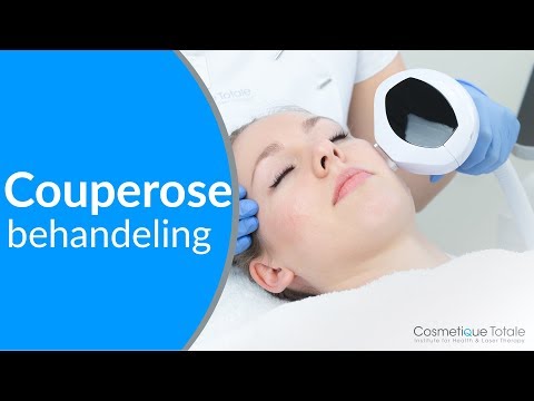 download lagu mp3 mp4 Couperose Verminderen, download lagu Couperose Verminderen gratis, unduh video klip Couperose Verminderen