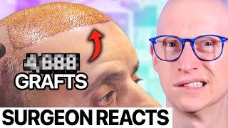 Why Istanbul Is The Place to Get Your Hair Back | Surgeon Reacts