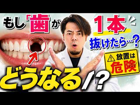 【放置は危険】もし歯が1本抜けたら…? どうなる!?
