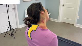 Something Is WRONG With Her Neck 😳 Toxic GUNK Sits In Skin - Dr. Ed 💪