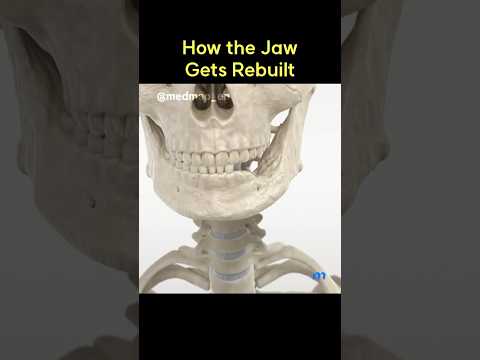 How the Jaw Gets Rebuilt