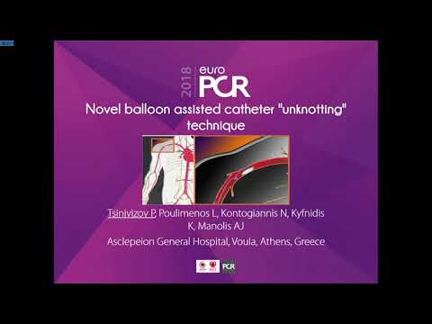 Coronary Radial catheter un knot, new balon technique.