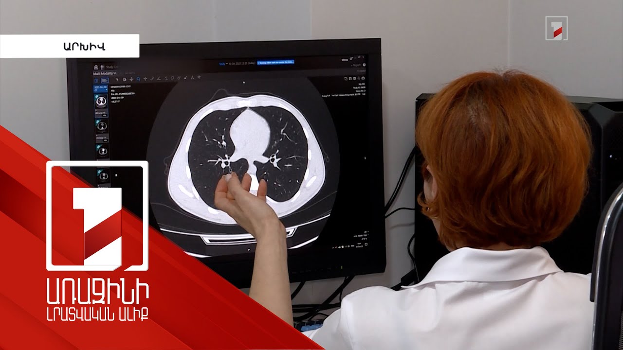 Քաղցկեղի ախտորոշման դեպքում 4 մլն դրամի փոխհատուցումը կարելի է ծախսել ոչ հայկական կլինիկաներում