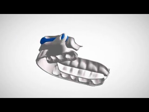 ResMed introducing and featuring Narval CC