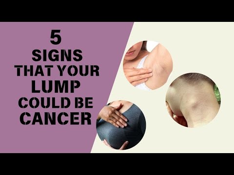 5 SIGNS That Your Neck or Armpit LUMP COULD Be CANCER