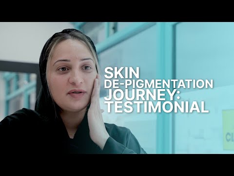 Best Hyperpigmentation /Melasma Treatment London - Review – Saba #hyperpigmentation #melasma #female