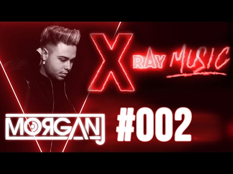 X-RAY Music #002 (Special Guest MorganJ+ Interview)