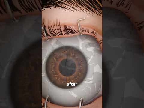 What Would Happen If You Stopped Blinking? 😱