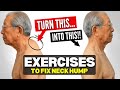 Japan S Oldest Doctor How To Fix A Neck Hump At Home FAST