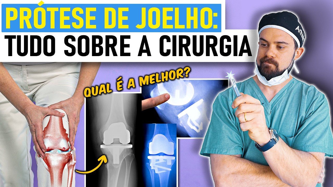 Prótese de Joelho: Como é a Cirurgia? Qual a Melhor Prótese? [Aulão c/ Ortopedista]