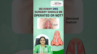 Is Surgery Required for Every DNS (Deviated Nasal Septum) Case? | Dr Harika