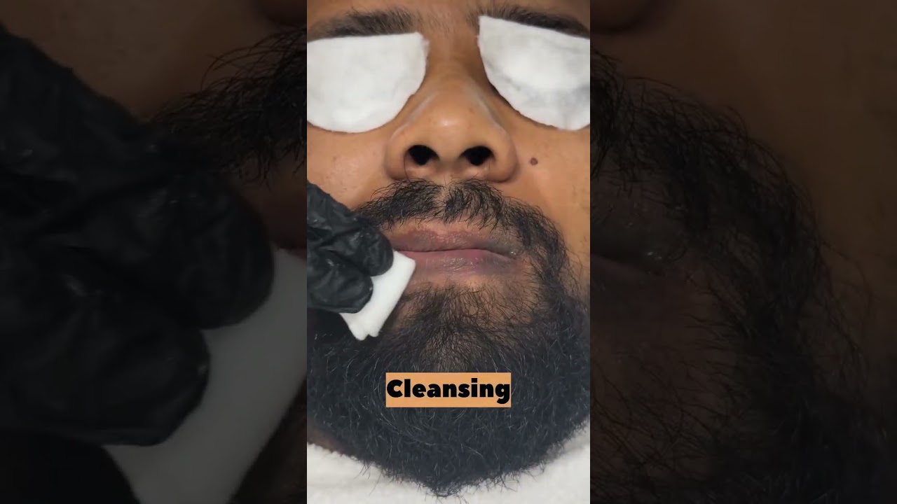 Laser Lip Lightening 👄