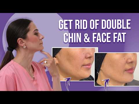 Reduce Double Chin