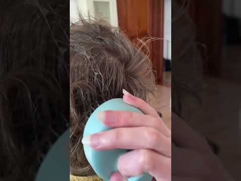 GEHEIMTIPP Apfelessig gegen Schuppen💇🏼✨ nach 1 Anwendung sind sie komplett weg! | officialjosi