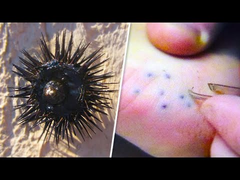 20 Most Painful Animal Stings You Can Experience