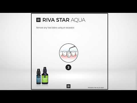 Riva Star Aqua - Arresting caries without restoration - Step by step instructions