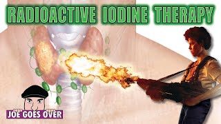 Radioactive Iodine Therapy