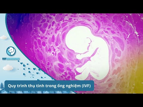 Quy Trình Thụ Tinh Ống Nghiệm IVF Diễn Ra Như Thế Nào ?