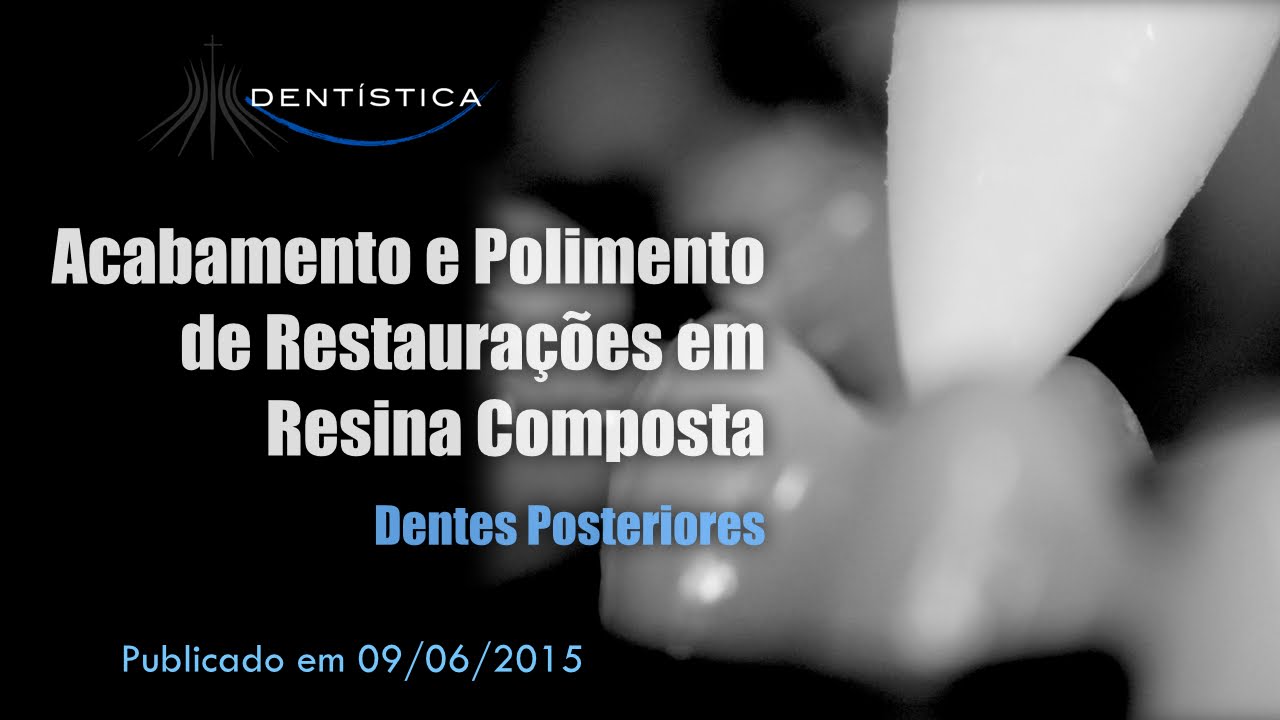 Acabamento e Polimento de Restaurações Posteriores em Resina Composta
