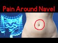 Stomach Pain Around The Navel 7 Causes Of Periumbilical Pain