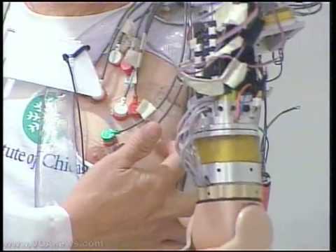 Brain Controls Artificial Arm