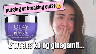 Download lagu Update Olay Retinol 24 (after 2weeks) / Fragrance Free / Miles Poblete mp3