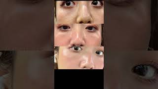 皮膚管理 ｜ 水煮蛋肌養成｜ 找回肌膚光采｜ 璀璨鑽石課程