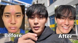 How to ACTUALLY get better skin