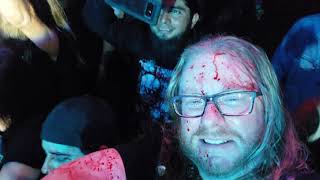 Exhumed   Open the Abscess