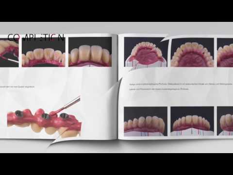 KZW 2017 - best documentation