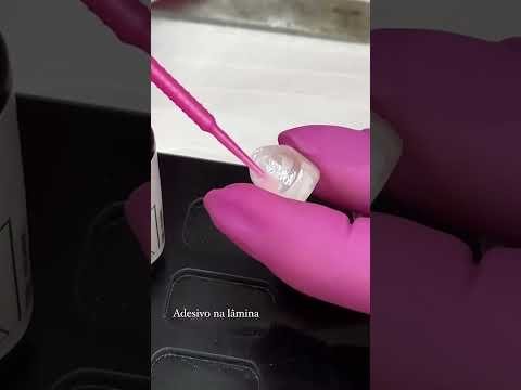 LENTES DE CONTATO DENTAL, pelo Dr Gustavo Caetano.