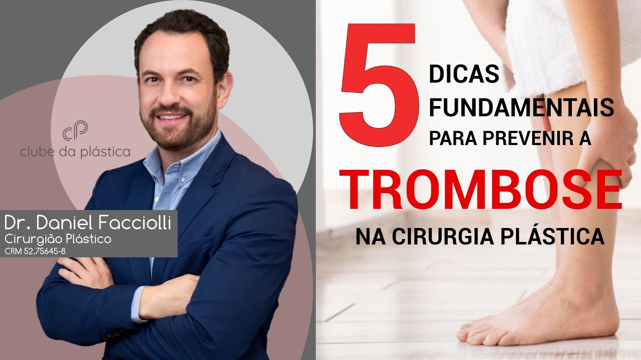 Clube da Plástica: 5 dicas fundamentais para prevenir a trombose na cirurgia plástica