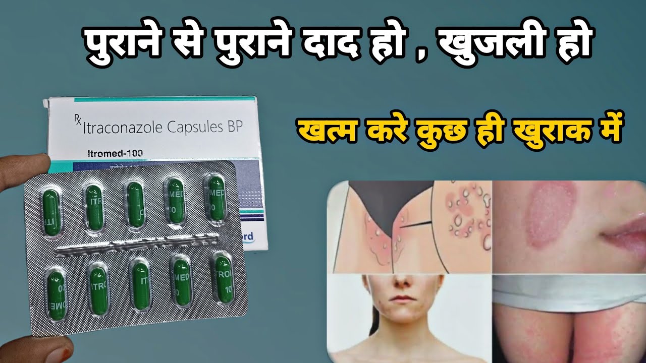 itraconazole capsules 100mg | itromed 100 capsule uses in hindi | दाद हो , खुजली हो ख़त्म करे