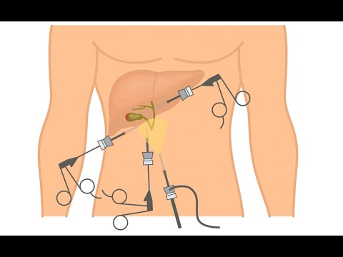 Diagnostic Laparoscopy Cpt Code
