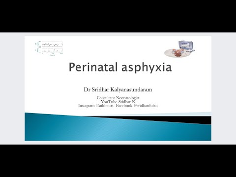 Perinatal asphyxia-an overview of the pathophysiology and overview of HIE. Dr Sridhar K